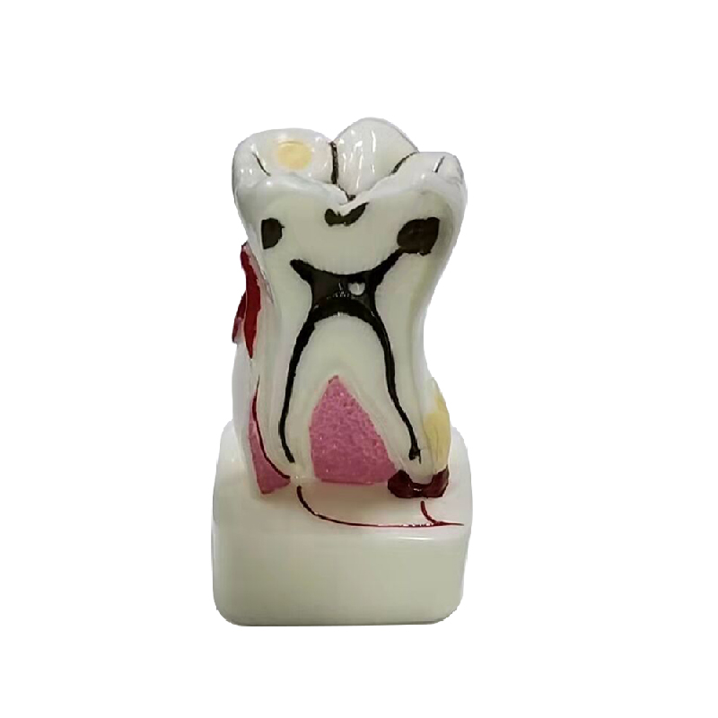 Modelo de perfil anatômico UM-AA1 do molar mandibular (6 vezes o tamanho natural)
   