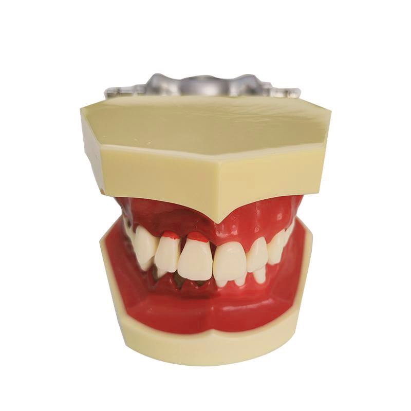 Modelo periodontal UM-4025
   