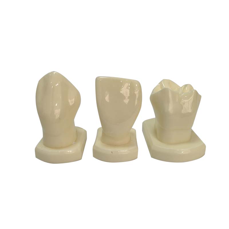 UM-U15 Modelo de guia de 3 vezes para escultura dentária
   