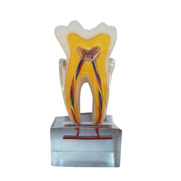 UM-U14 Modelo de anatomia dentária seis vezes normal
   