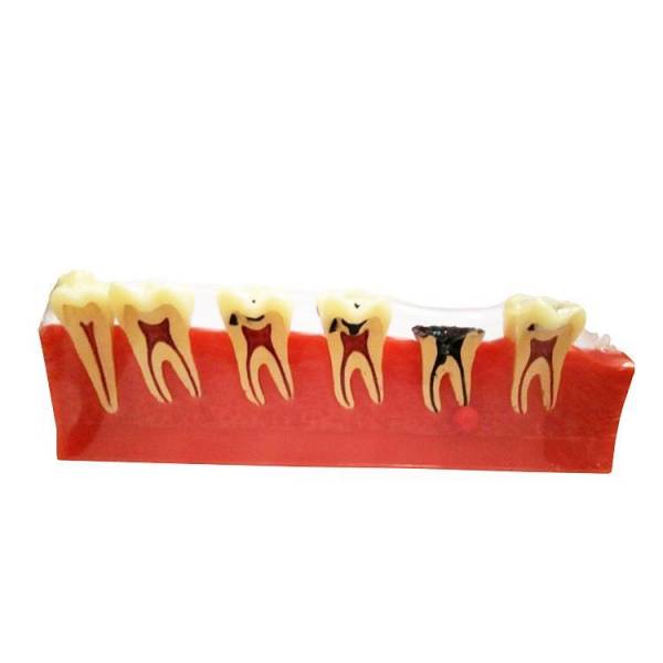 Modelo de classificação de doenças periodontais UM-E8
   