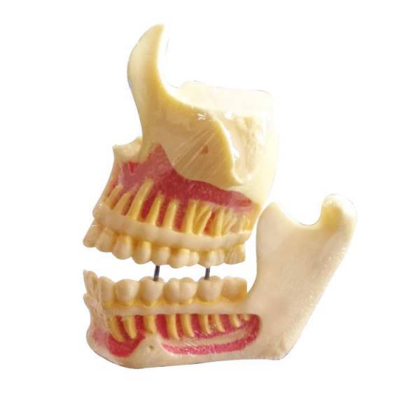 UM-F1 modelos educacionais de mandíbula superior e mandíbula