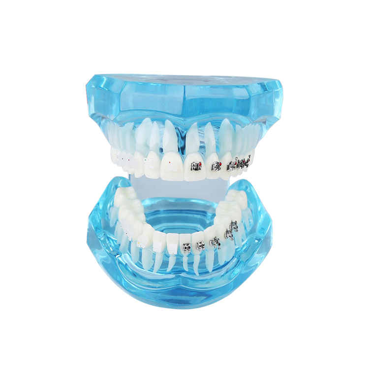 UM-B21 dentição transparente com suportes
