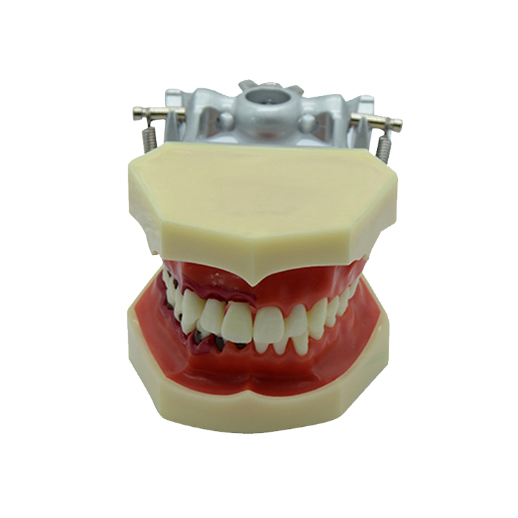 Modelo periodontal UM-4025