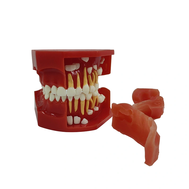 Modelo de desenvolvimento dentural UM-S12A A (3-6 anos de idade)